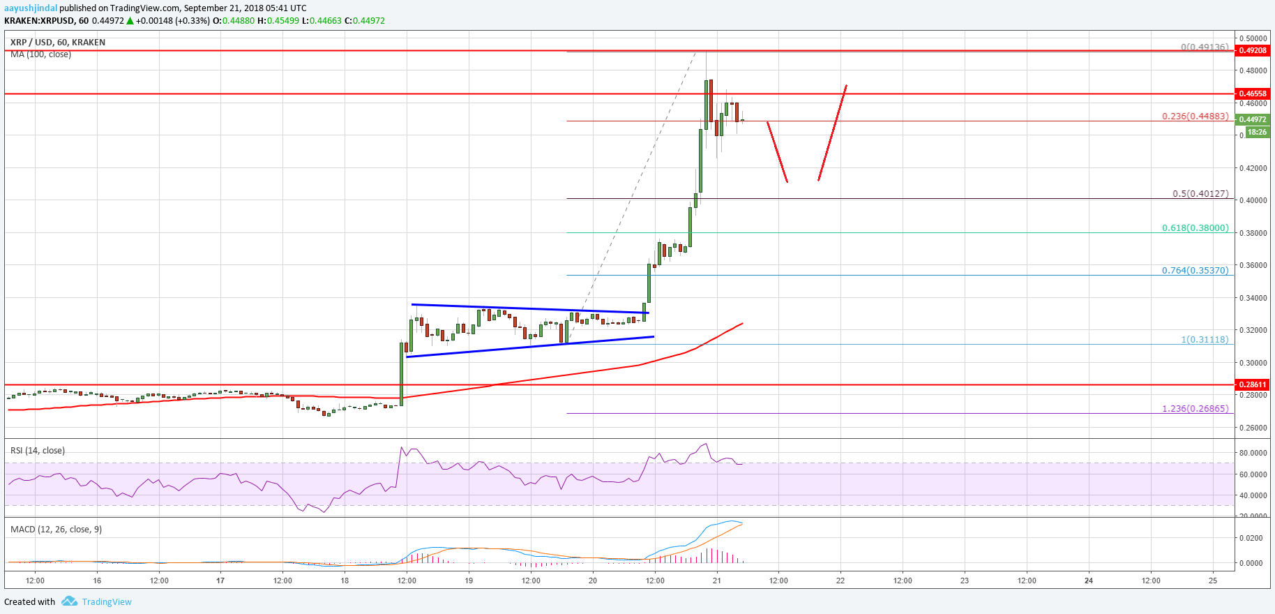 Ripple Price Analysis XRP USD Chart