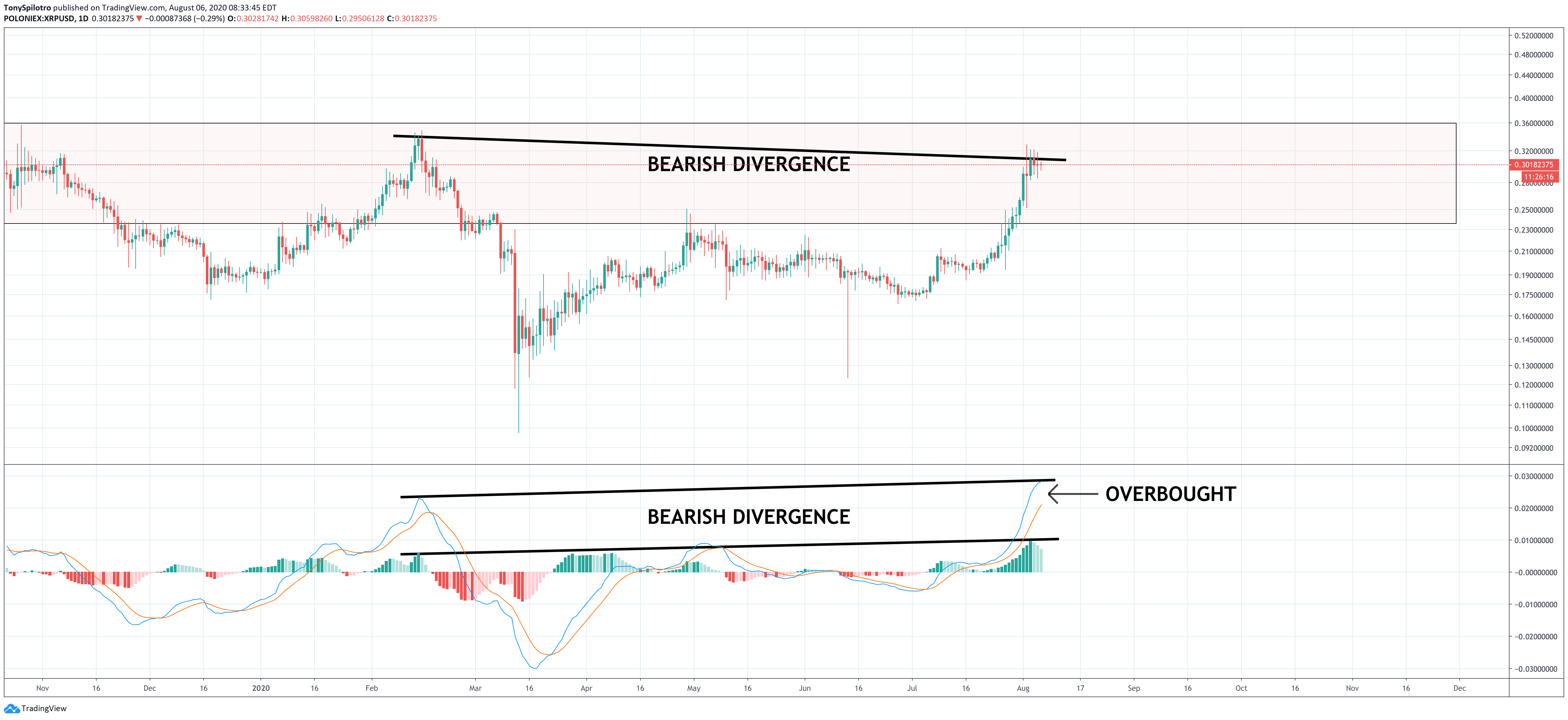 xrp macd daily bear div