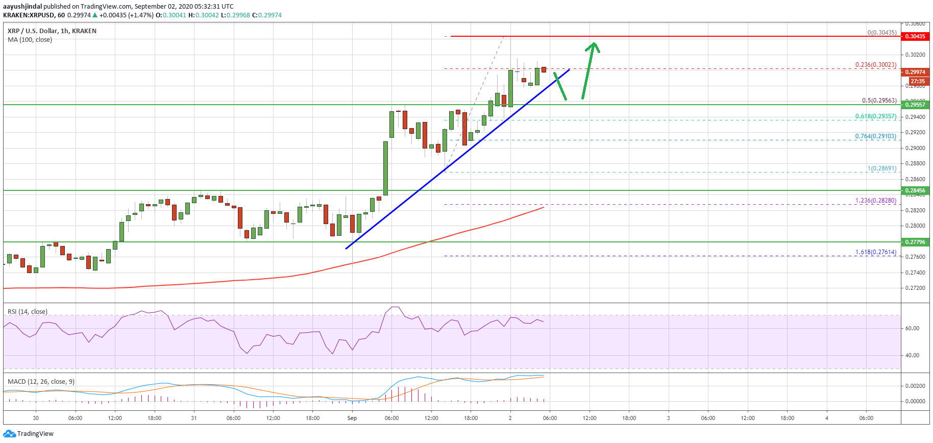 Ripple (XRP)