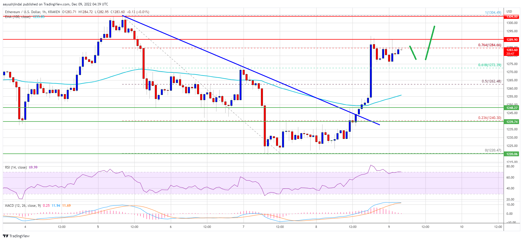 Ethereum Price