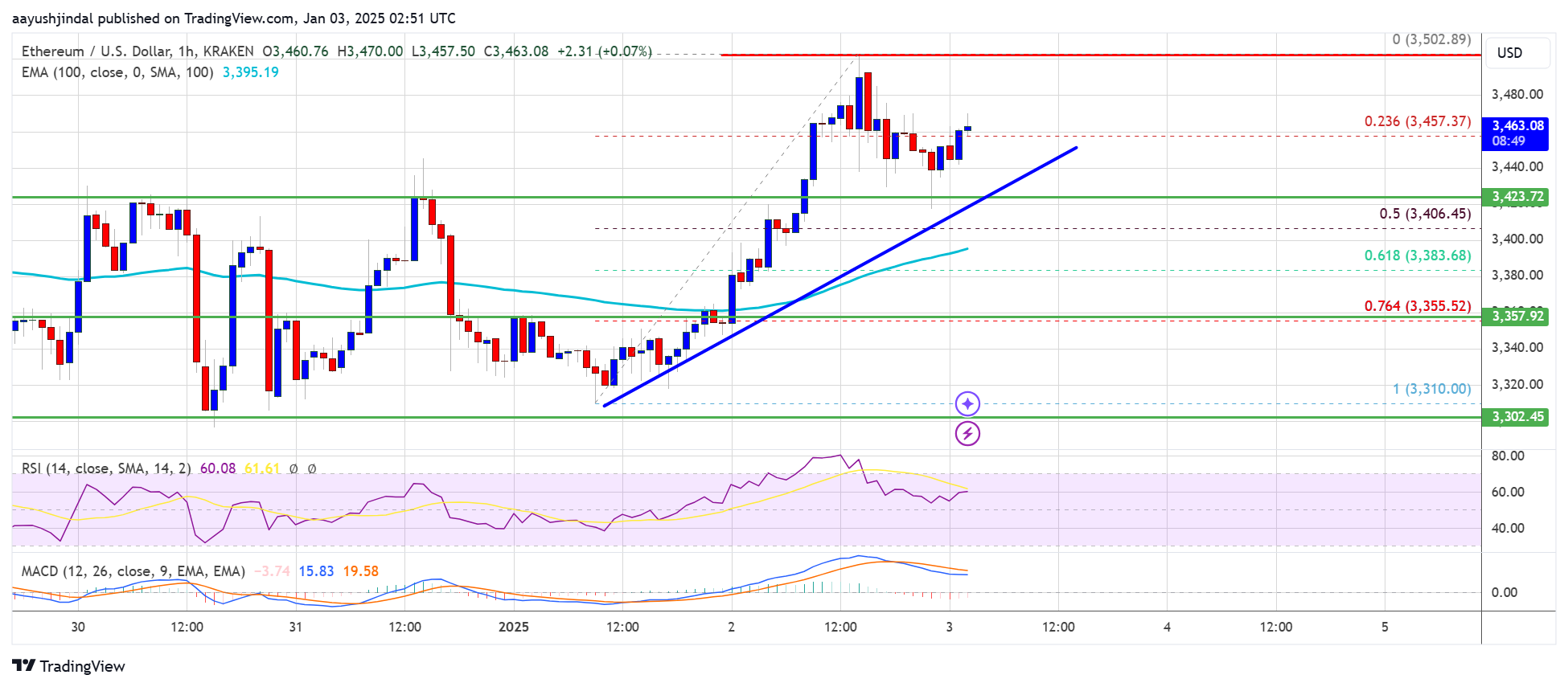 Precio de Ethereum